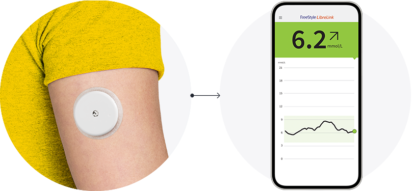 Libre 2 Continuous [14 day] Glucose Monitor by FreeStyle