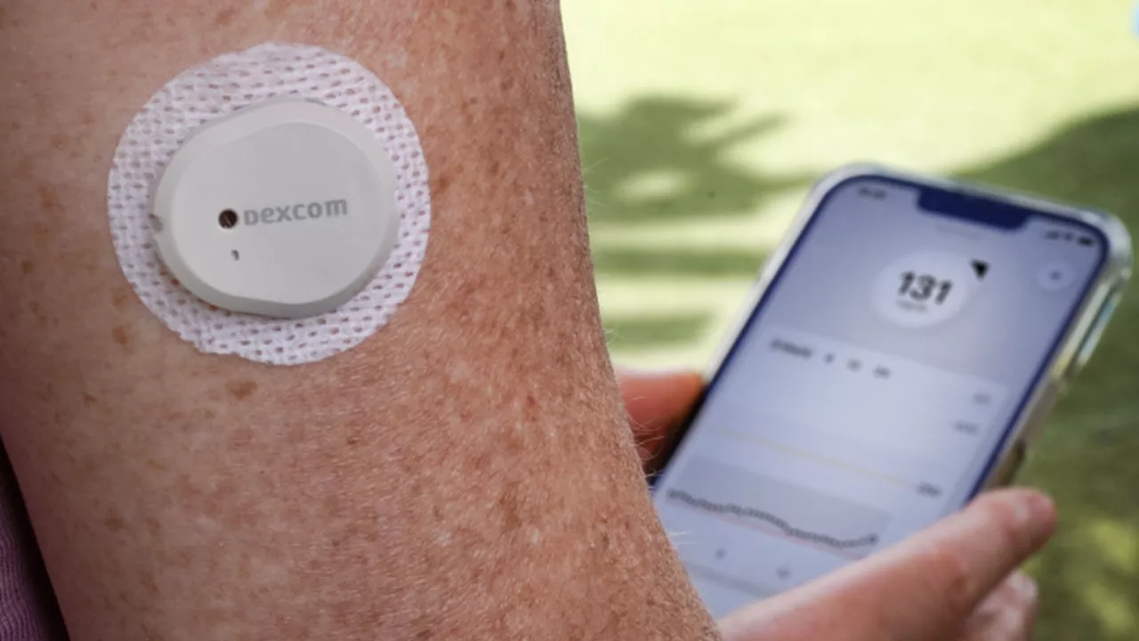 [GLUCOSE MONITORING] Dexcom G7 (10-Day Patch)